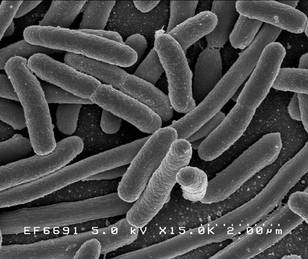Бациллы кишечной палочки (Escherichia coli) / Википедия