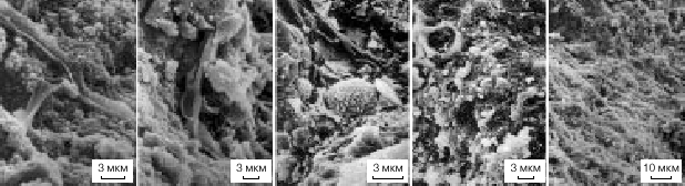 Коккоидные и нитчатые цианобактерии и грибы из метеорита Мерчисон