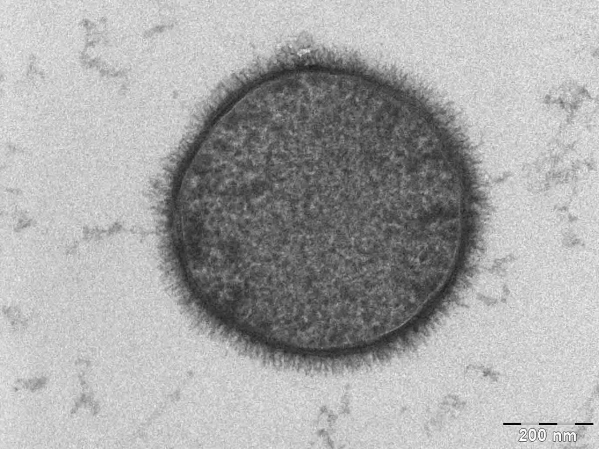 Сенная палочка (Bacillus subtilis) / © Wikipedia/Allon Weiner/The Weizmann Institute of Science