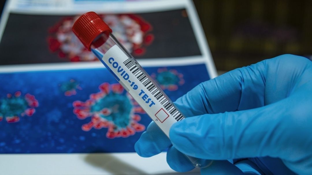 В российских штаммах коронавируса не нашли значимых изменений